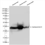 Apolipoprotein E Antibody in Western Blot (WB)