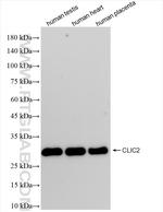 CLIC2 Antibody in Western Blot (WB)