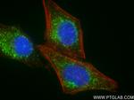 ACOX1 Recombinant Rabbit Monoclonal Antibody (240754D3)