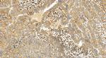 ACOX1 Antibody in Immunohistochemistry (Paraffin) (IHC (P))