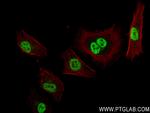 POT1 Antibody in Immunocytochemistry (ICC/IF)