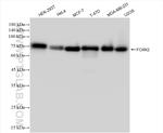 FOXK2 Antibody in Western Blot (WB)