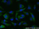 CBR1 Antibody in Immunocytochemistry (ICC/IF)