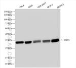 CBR1 Antibody in Western Blot (WB)