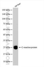 Crp Antibody in Western Blot (WB)