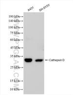 Cathepsin D Recombinant Rabbit Monoclonal Antibody (240775E7)