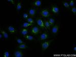 Cathepsin D Antibody in Immunocytochemistry (ICC/IF)