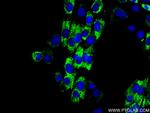 COL1A2 Antibody in Immunocytochemistry (ICC/IF)