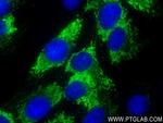 COL1A2 Antibody in Immunocytochemistry (ICC/IF)