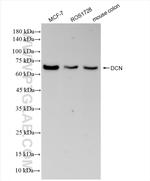 Decorin Antibody in Western Blot (WB)