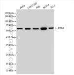 PAK4 Antibody in Western Blot (WB)