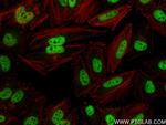 HNRNPA2B1 Antibody in Immunocytochemistry (ICC/IF)