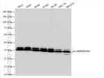 HNRNPA2B1 Antibody in Western Blot (WB)