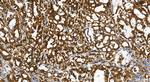 BAG3 Antibody in Immunohistochemistry (Paraffin) (IHC (P))