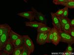 TDG Antibody in Immunocytochemistry (ICC/IF)