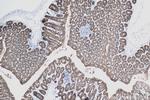 Cadherin-17 Antibody in Immunohistochemistry (Paraffin) (IHC (P))