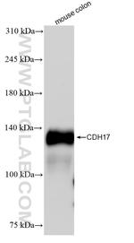 Cadherin-17 Antibody in Western Blot (WB)