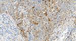 5 Lipoxygenase Antibody in Immunohistochemistry (Paraffin) (IHC (P))