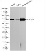 5 Lipoxygenase Antibody in Western Blot (WB)