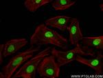 CSNK2A1 Antibody in Immunocytochemistry (ICC/IF)