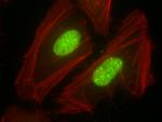 CSNK2A1 Antibody in Immunocytochemistry (ICC/IF)