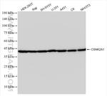 CSNK2A1 Antibody in Western Blot (WB)
