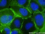 EGFR Antibody in Immunocytochemistry (ICC/IF)