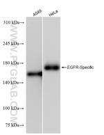 EGFR Antibody in Western Blot (WB)