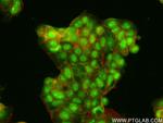 GATA3 Antibody in Immunocytochemistry (ICC/IF)