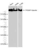 TP53BP1 Antibody in Western Blot (WB)