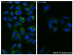 ATG8L Antibody in Immunocytochemistry (ICC/IF)