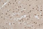 COPS3 Antibody in Immunohistochemistry (Paraffin) (IHC (P))