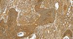ALDH1A1 Antibody in Immunohistochemistry (Paraffin) (IHC (P))