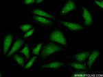 SMAD2 Antibody in Immunocytochemistry (ICC/IF)