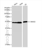 SMAD2 Antibody in Western Blot (WB)