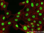 TRMT6 Antibody in Immunocytochemistry (ICC/IF)