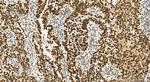 TRMT6 Antibody in Immunohistochemistry (Paraffin) (IHC (P))