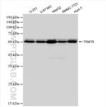 TRMT6 Antibody in Western Blot (WB)