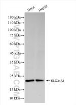 SLC31A1 Antibody in Western Blot (WB)