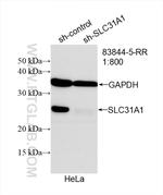 SLC31A1 Antibody in Western Blot (WB)