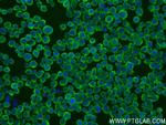 CYFIP2 Antibody in Immunocytochemistry (ICC/IF)