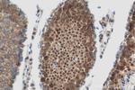 USP53 Antibody in Immunohistochemistry (Paraffin) (IHC (P))