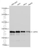USP53 Antibody in Western Blot (WB)