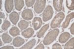 IQUB Antibody in Immunohistochemistry (Paraffin) (IHC (P))