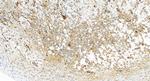 PTPN12 Antibody in Immunohistochemistry (Paraffin) (IHC (P))