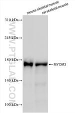 MYOM3 Antibody in Western Blot (WB)