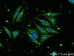 FAM127B Antibody in Immunocytochemistry (ICC/IF)