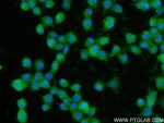 CAMSAP1 Antibody in Immunocytochemistry (ICC/IF)