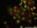 Thyroid Hormone Receptor beta Antibody in Immunocytochemistry (ICC/IF)