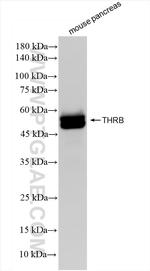 Thyroid Hormone Receptor beta Antibody in Western Blot (WB)